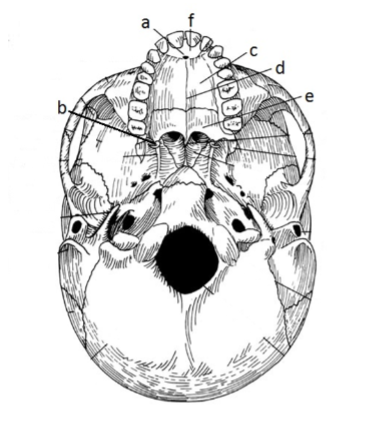 <p>129. _____ intermaxillary suture</p>