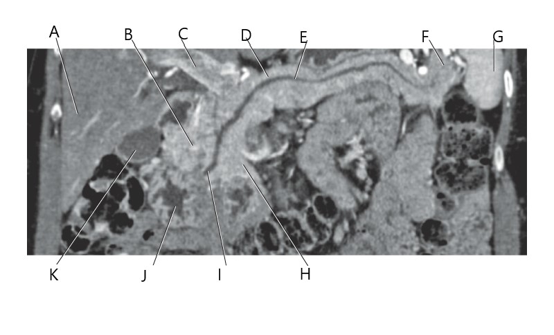 <p>A</p>