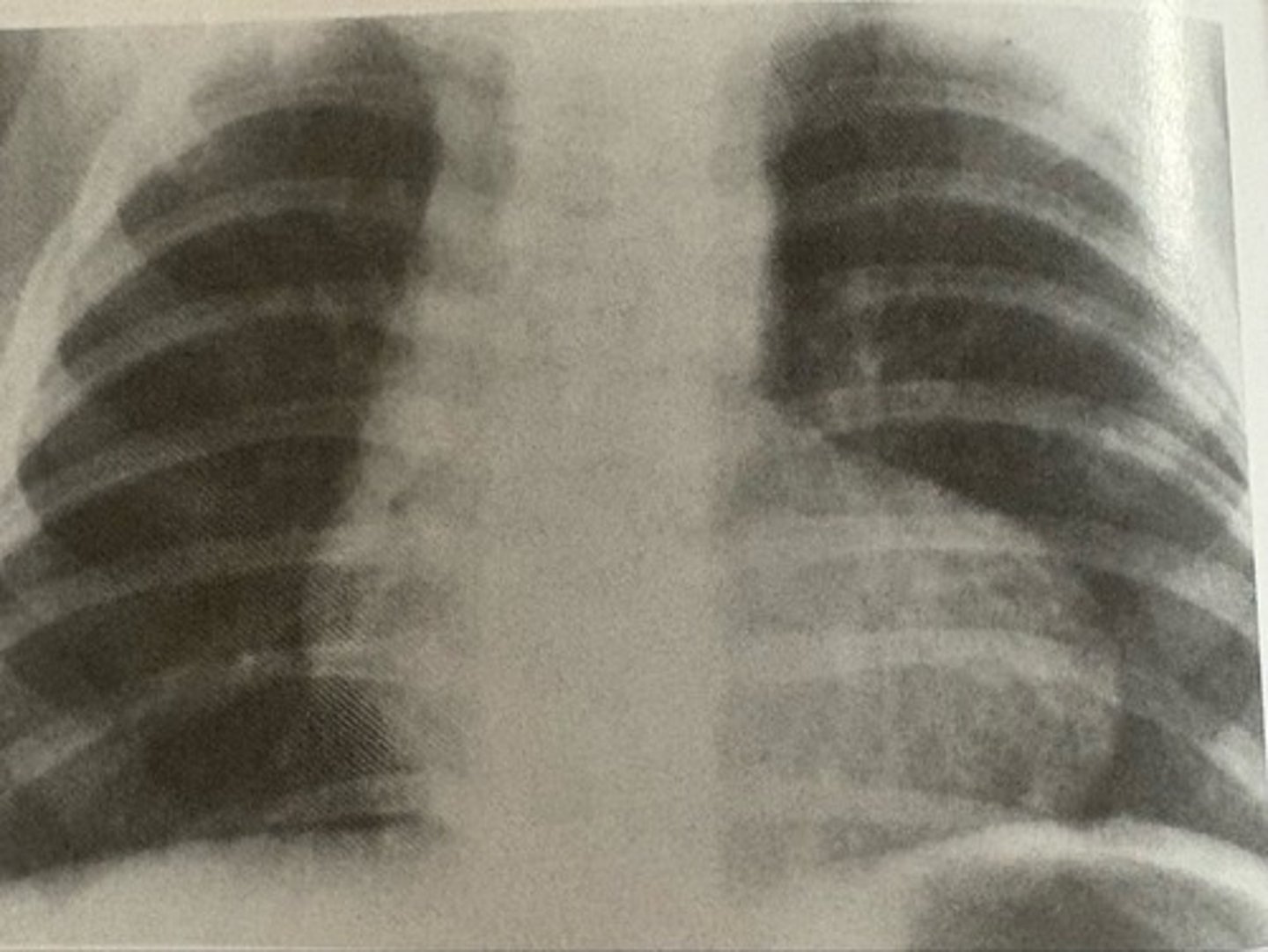 <p>what pathology is present?</p>