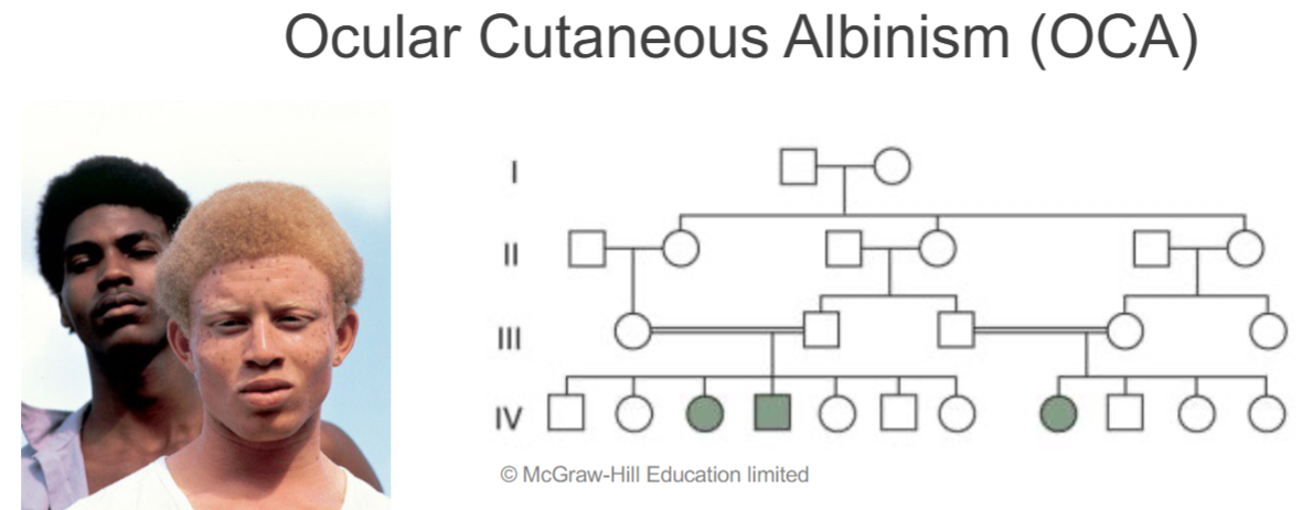 <ul><li><p>4 key aspects of pedigrees w/ recessive traits:</p><ol><li><p>affected individuals can be children of 2 unaffected carriers, particularly as the result of consanguineous matings</p></li><li><p>all children of 2 affected parents should be affected</p></li><li><p><strong><u>rare</u></strong> recessive traits show <strong>horizontal pattern</strong> of inheritance: trait first appears among several members of one generation and is not seen in earlier generations</p></li><li><p>recessive traits may show <u>vertical pattern</u> of inheritance if trait is <u>extremely common</u> in the population</p></li></ol></li></ul>