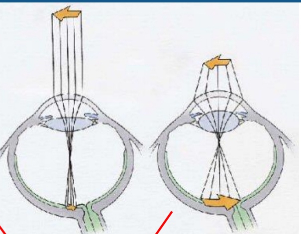 <ul><li><p>Eye changes its focus</p></li><li><p>Monocular</p></li></ul><p></p>