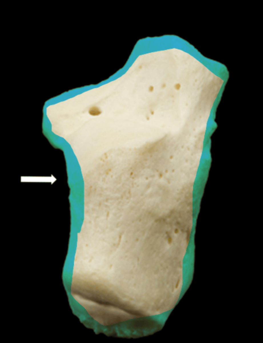 <p>name the part</p>