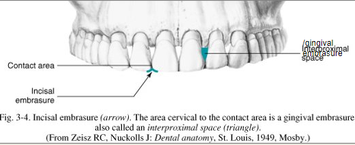 <p>Spillways are the spaces between teeth that are occlusal to the contact areas.</p><p><strong>Purpose</strong>:</p><ul><li><p>Allow food to be moved away from contact areas</p></li><li><p>Dissipate and reduce the forces of occlusal trauma</p></li><li><p>Provide self-cleaning by the action of the tongue, cheeks, and lips</p></li><li><p>Protect the gingiva from undue trauma. </p></li></ul><p><strong>Named for their location in relation to the contact area.</strong></p><ul><li><p>Facial (buccal or labial)</p></li><li><p>Lingual</p></li><li><p>Incisal</p></li><li><p>Occlusal</p></li></ul><p></p>