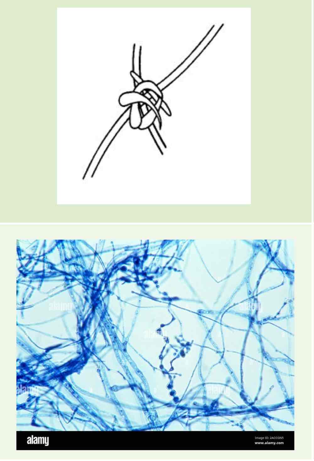 <p>Name this hyphae</p>