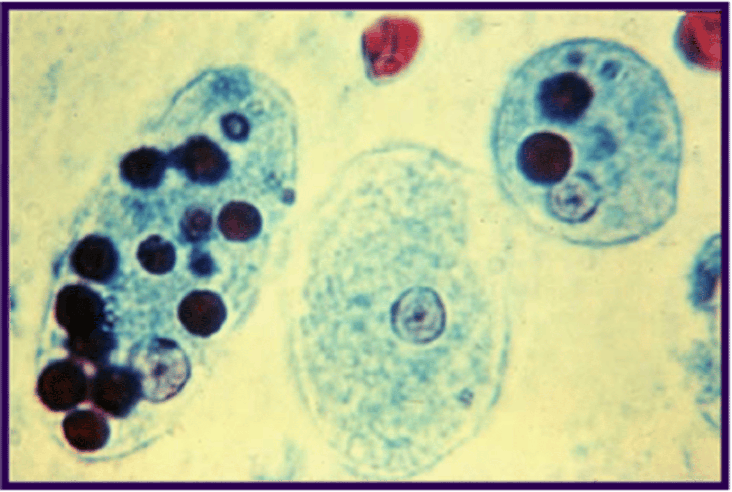 <p>ingested RBCs</p>