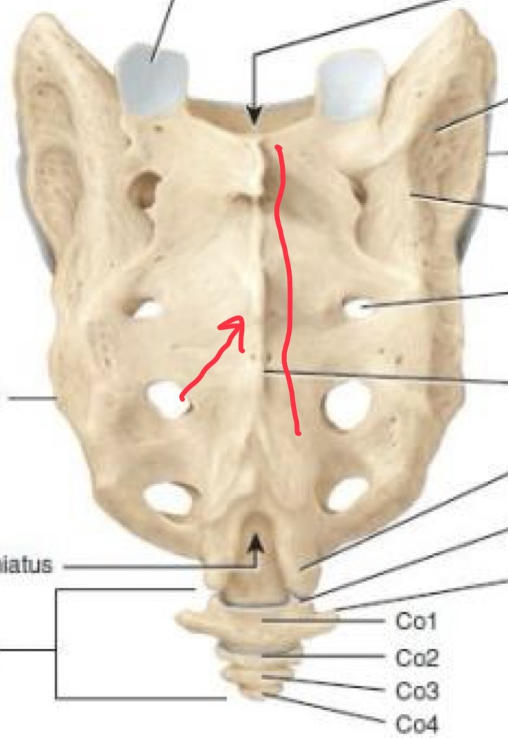 <p>(Ridge) occurs along the midline </p>