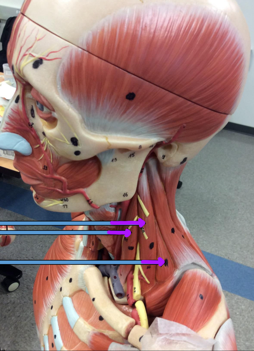 <p>Identify this muscle?</p>