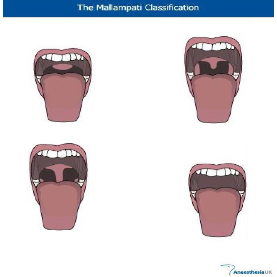 RESP 1420 Anatomy and Function Flashcards Knowt