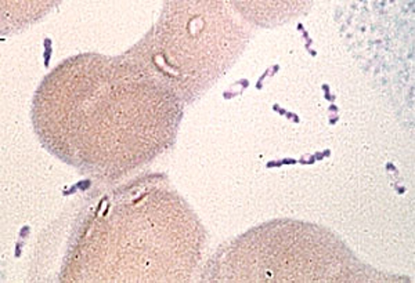 <p>Identify Pathogen causing Diarrhea:</p><p>Nonmotile, Gram-negative, Facultative Intracellular Bacillus</p><p>-Hx:</p><p>&gt; Transmitted via pet feces, contaminated milk, or pork</p><p>&gt; A/w Reactive Arthritis (if HLA-B27 +)</p><p>-Path: Can invade Peyer's patches -&gt; organisms multiply in mesenteric lymph nodes -&gt; lead to granulomatous microabscesses in the lymph tissue -&gt; inflammation of mesenteric lymph nodes (mesenteric adenitis)</p><p>-Sx/PE:</p><p>&gt; Low-grade fefver</p><p>&gt; Diarrhea (bloody if severe)</p><p>&gt; Children = Pseudoappendicitis (Inflammation of terminal ileum and mesenteric LNs, but appendix normal) --&gt; RLQ Pain d/t mesenteric adenitis and/or terminal ilietis</p><p>-Dx:</p><p>&gt; Non-lactose fermenting</p><p>&gt; (-) Oxidase</p><p>&gt; Requires Iron</p>