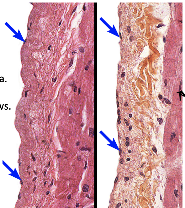 <p>What type of tissue are the blue arrows pointing to?</p>