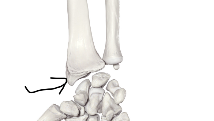 <p>Hoe heet dit deel?</p>