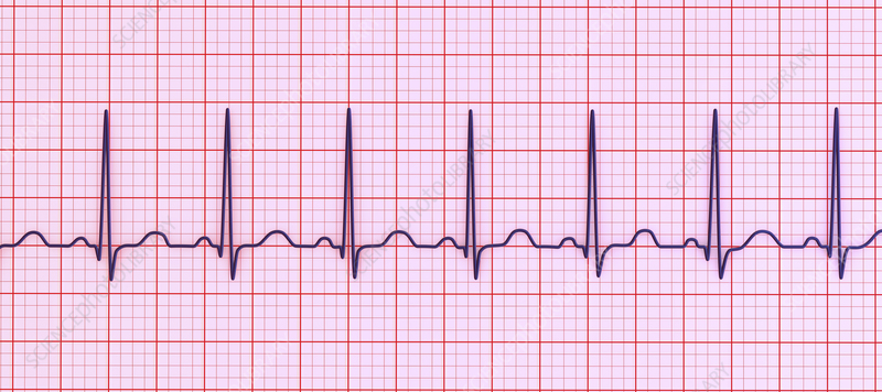 <p>Rhythm Interpretation</p>