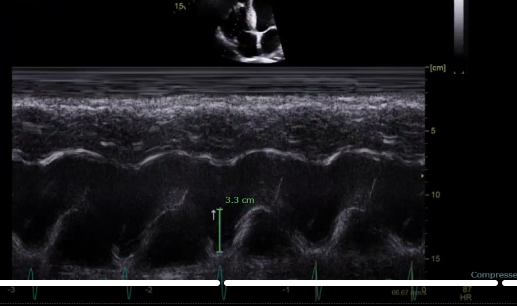 <p>what is the measurement for</p>