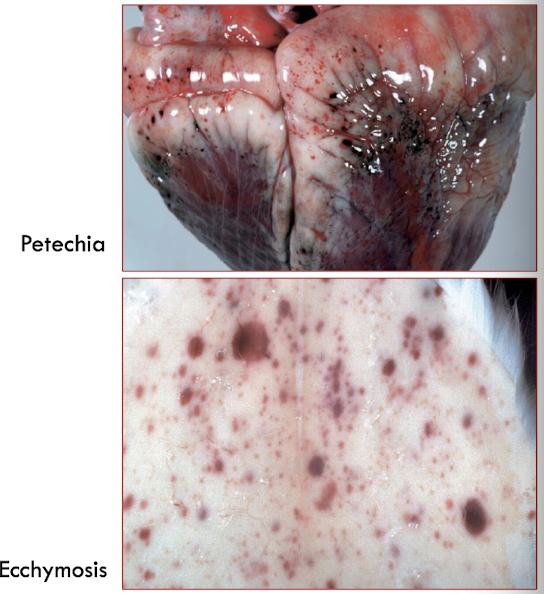 <ol><li><p>petechia → 1-2 mm</p></li><li><p>purpura → 3 mm - 1 cm</p></li><li><p>ecchymosis → 1-3 cm</p></li></ol><p></p>