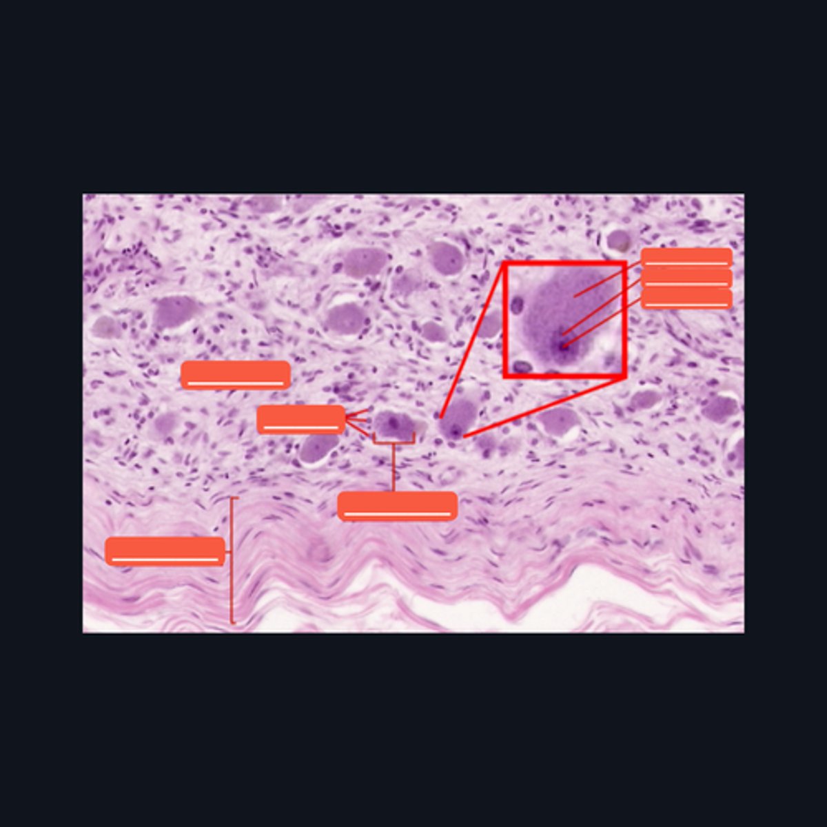 <p>What kind of motor neurons are present in this structure?</p>