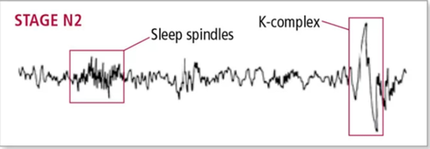 <p>Rapid bursts of high-frequency brain waves during stage 2 (N2) sleep that may help inhibit certain perceptions so we maintain a tranquil state during sleep. Sleep spindles in some parts of the brain are</p><p>associated with the ability to sleep through loud noises.</p>