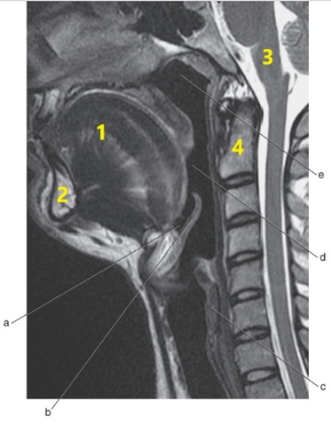 <p>What anatomy is letter b ?</p>