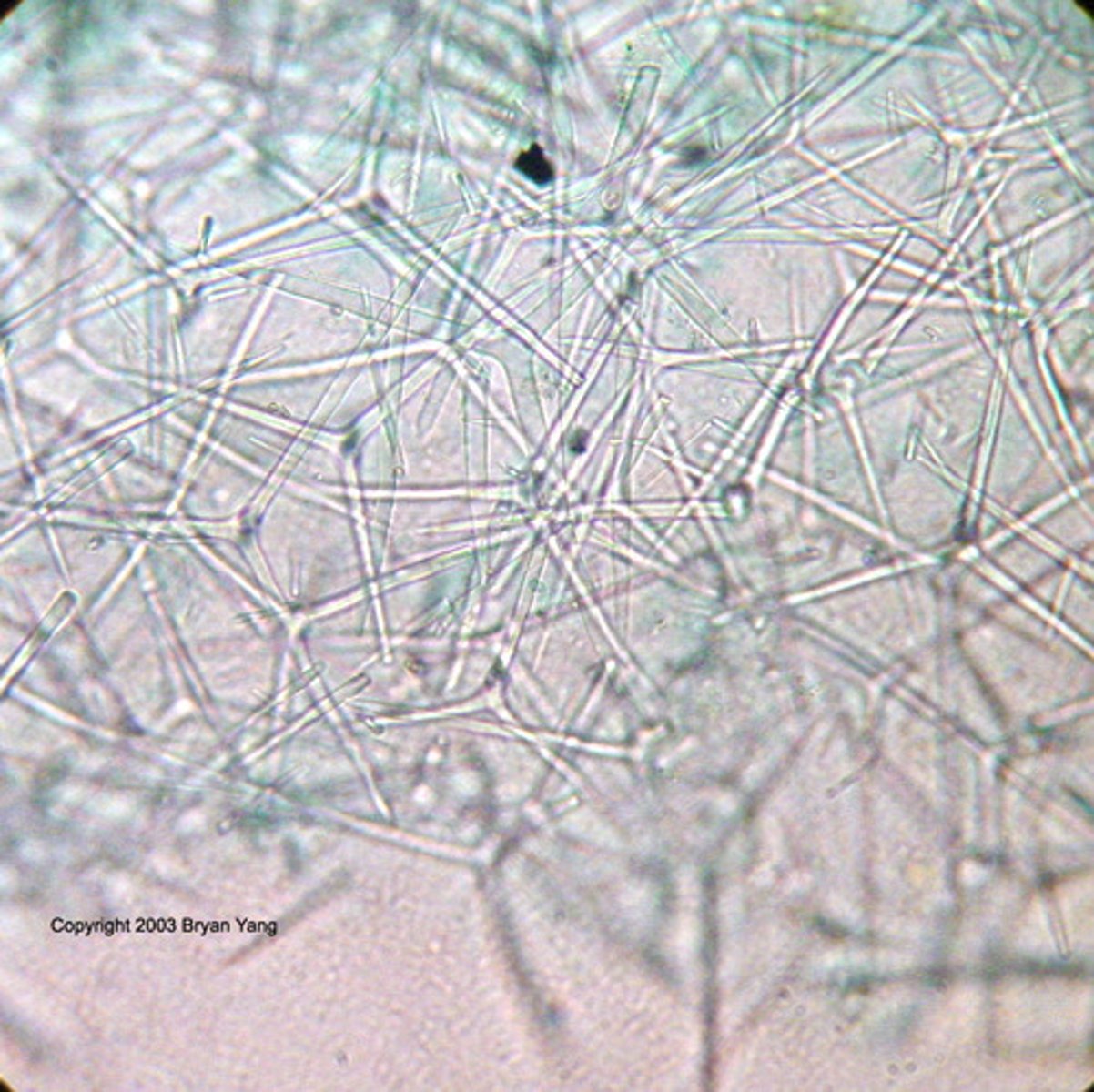 <p>Calcium carbonate or silica</p>