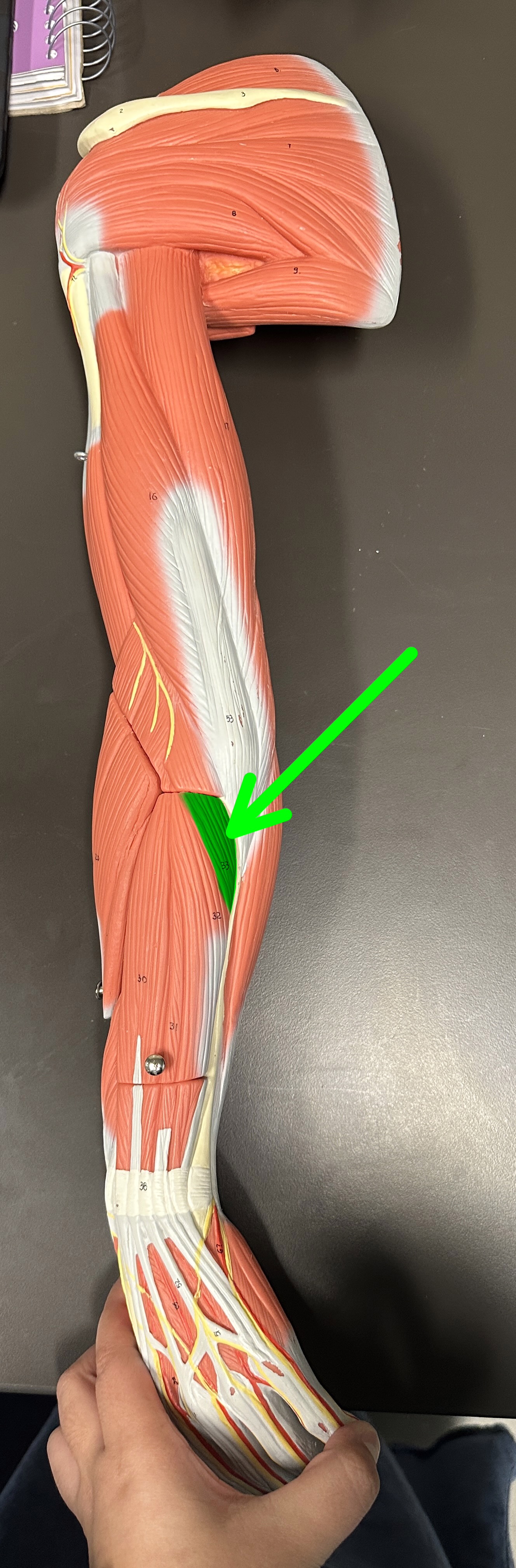 <p>What is the highlighted structure</p>