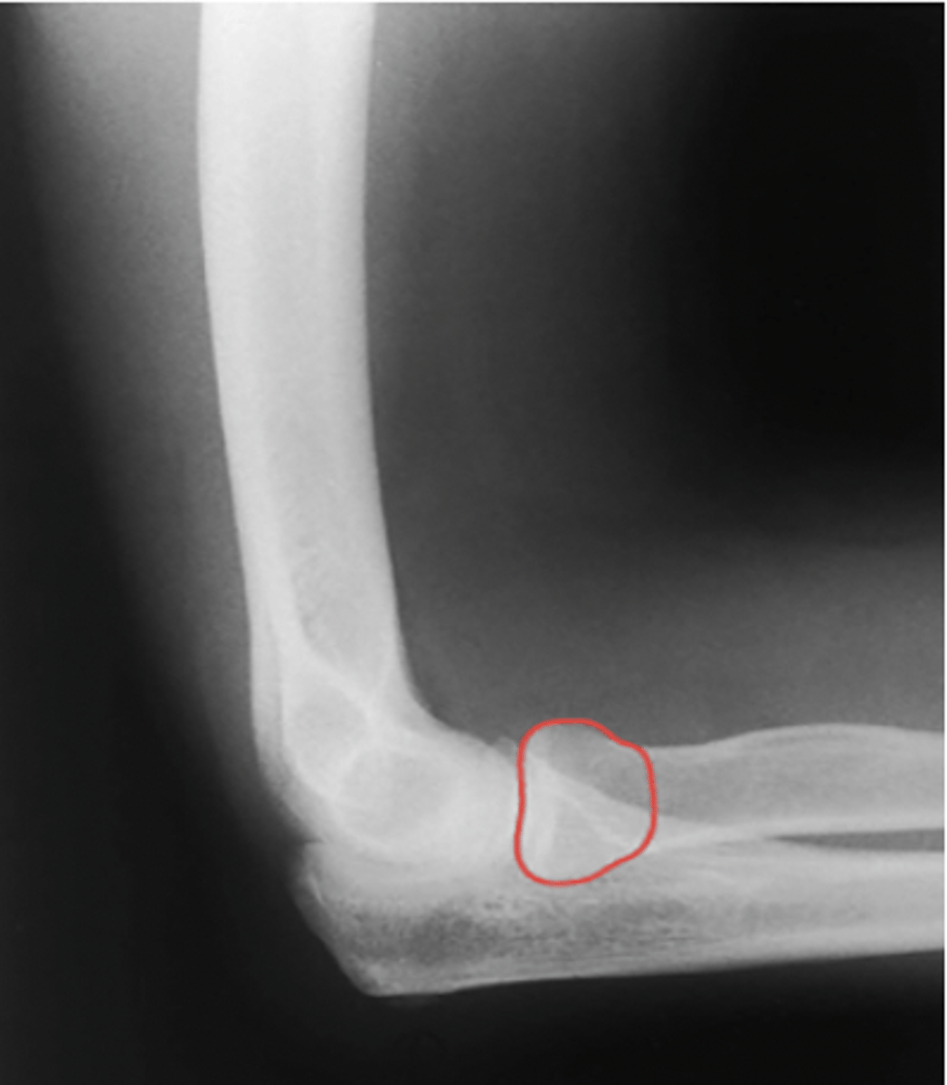 <p>What structure is highlighted?</p>