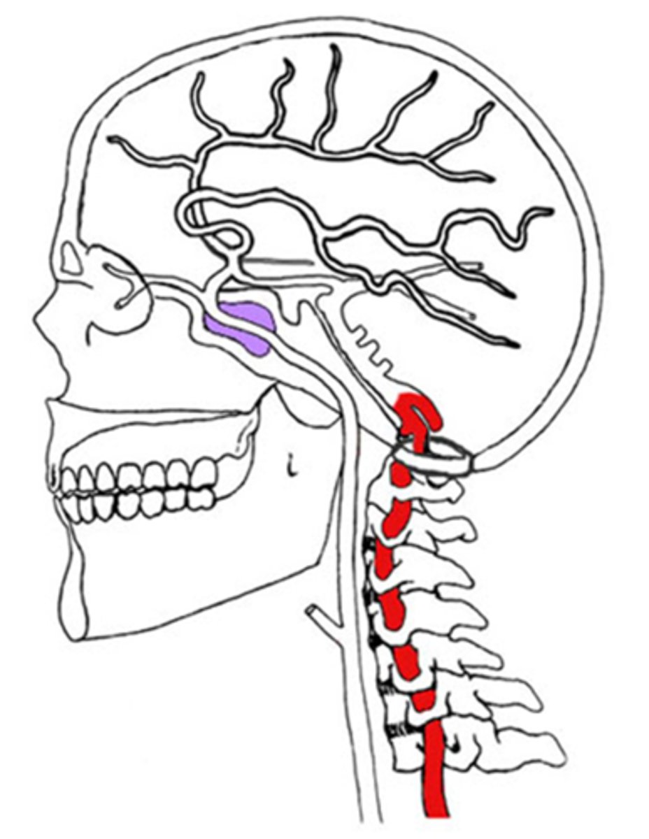 <p>How does <strong>vertebral-basilar insufficiency</strong> appear upon examination?</p>