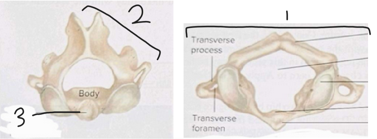 <p>What is #2?</p>