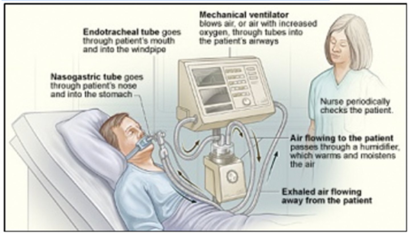 <p>Rationale</p><p>1. Pursed-lip breathing is not possible when the patient is intubated.</p><p>Diaphragmatic breathing, Deep breathing, and Lateral costal breathing ARE possible and helpful for a patient who has synchronized intermittent mandatory ventilation in ventilator mode, in which the patient is allowed to breathe spontaneously between machine-delivered breaths.</p>