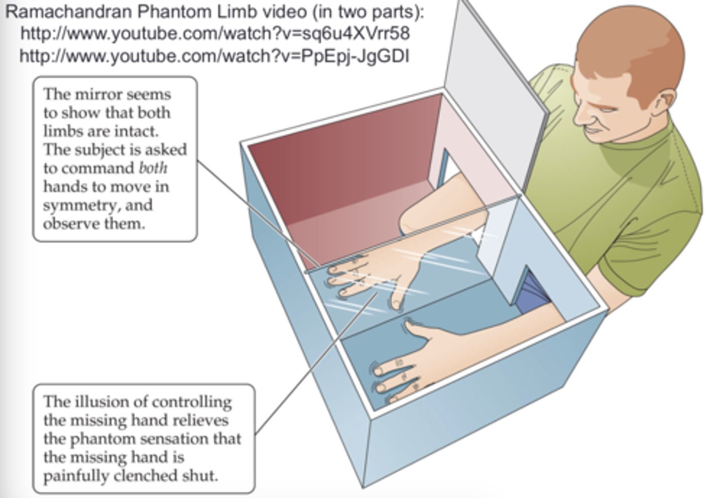 <p>mirror therapy &amp; virtual reality</p>
