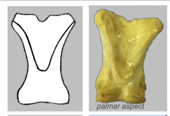 <p>Raised “V” on palmar surface</p><p>Function: Attachment oblique distal sesamoidean ligament</p>