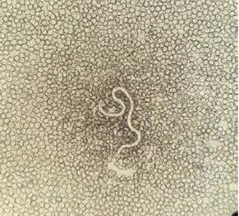 <p>A- what is the method of examination used here</p><p>B-identify the used technique</p><p>C- how to use it</p><p>D- what is the organism</p>