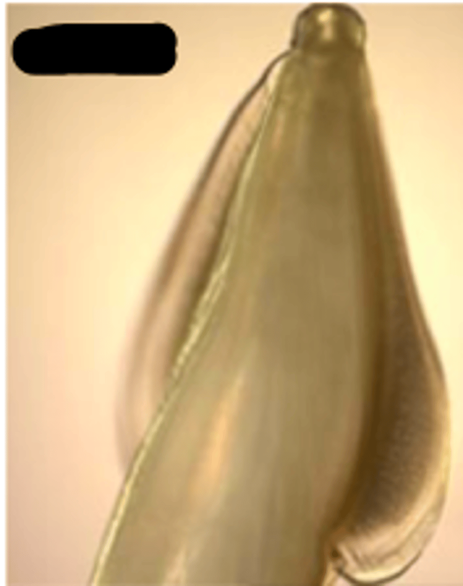 <p>Feline roundworm</p><p>-Adult worms w/prominent cervical alae</p><p>-Broad, arrow-like projections of cuticle</p>