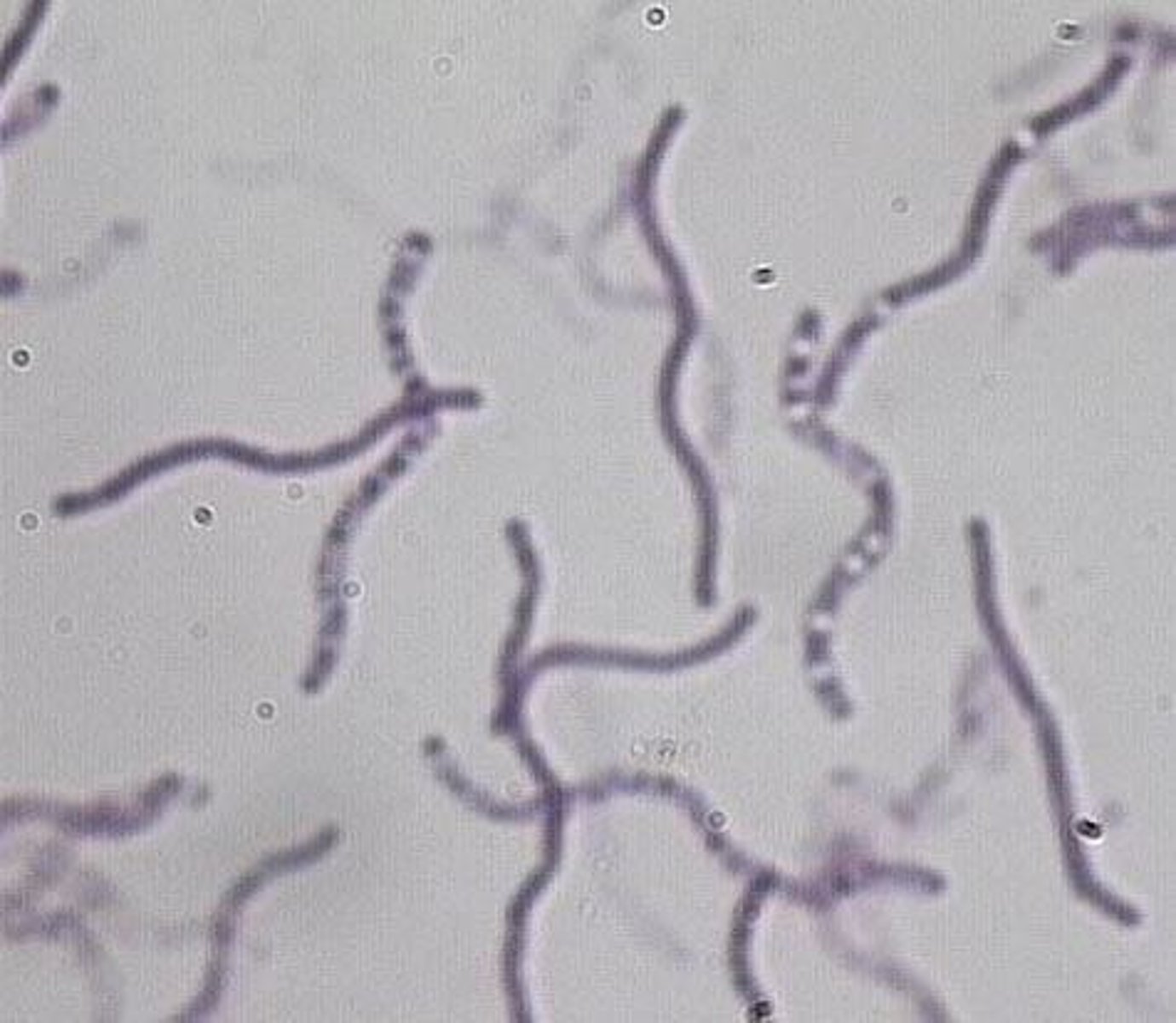 <p>Anthrax, also referred to as Woolsorters Disease.</p>