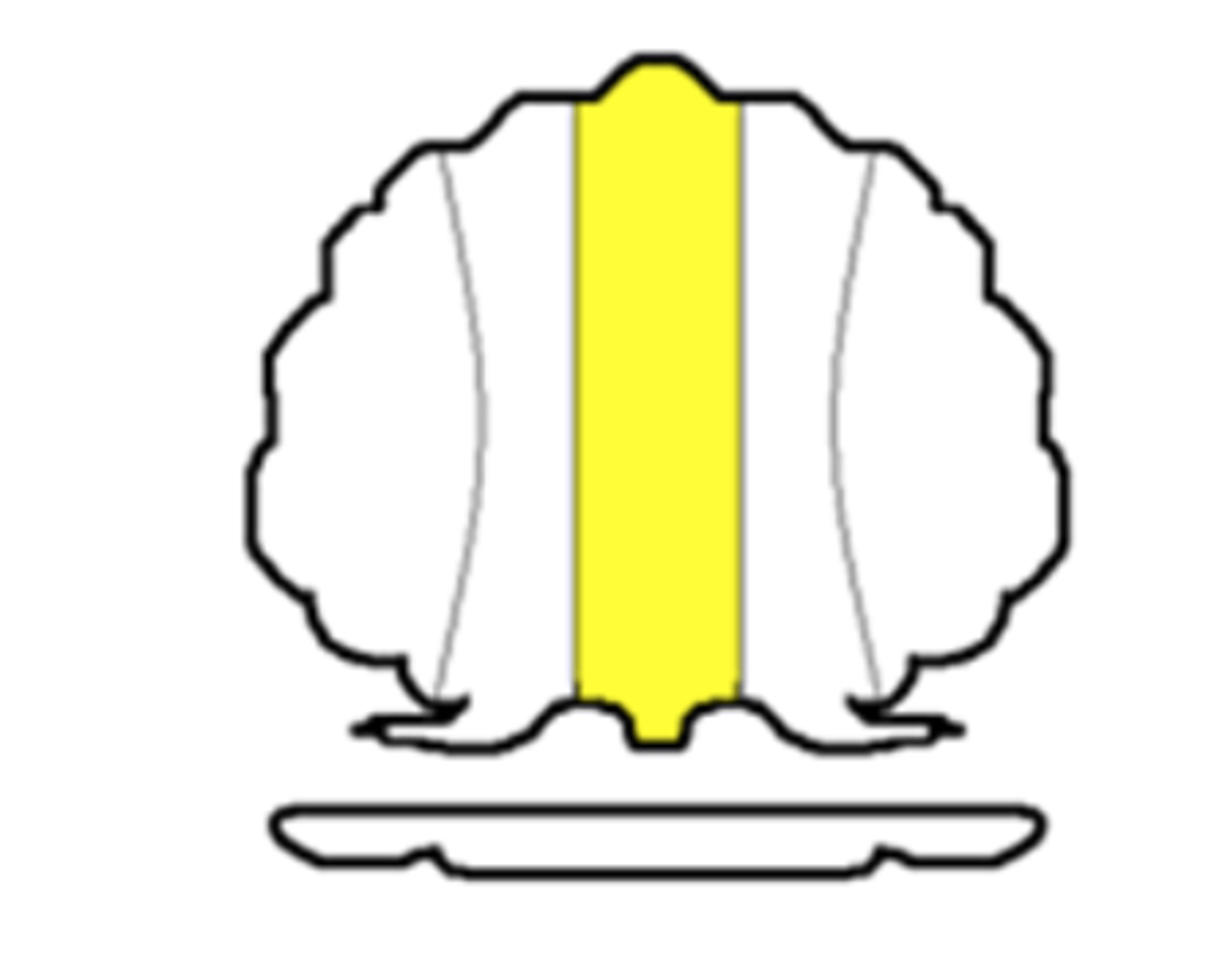 <p>Composed of flocculonodular lobe</p><p>Controls eye movement and axial musculature related to balance and posture</p><p>Connects two hemispheres of cerebellum</p>