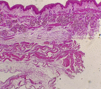 <p>What is the histology?</p>