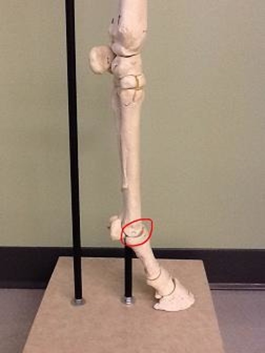 <p>Fetlock Joint</p>