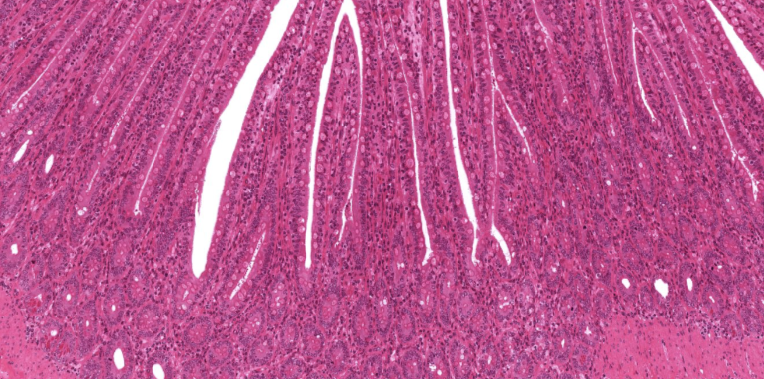 <p>Mucosa in Jejunum</p>
