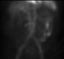 <p>What organ is being scanned here?</p><p>What organ system is it apart of?</p>