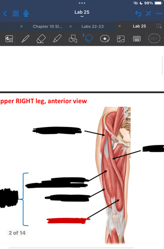 <p>What muscle is this?</p>