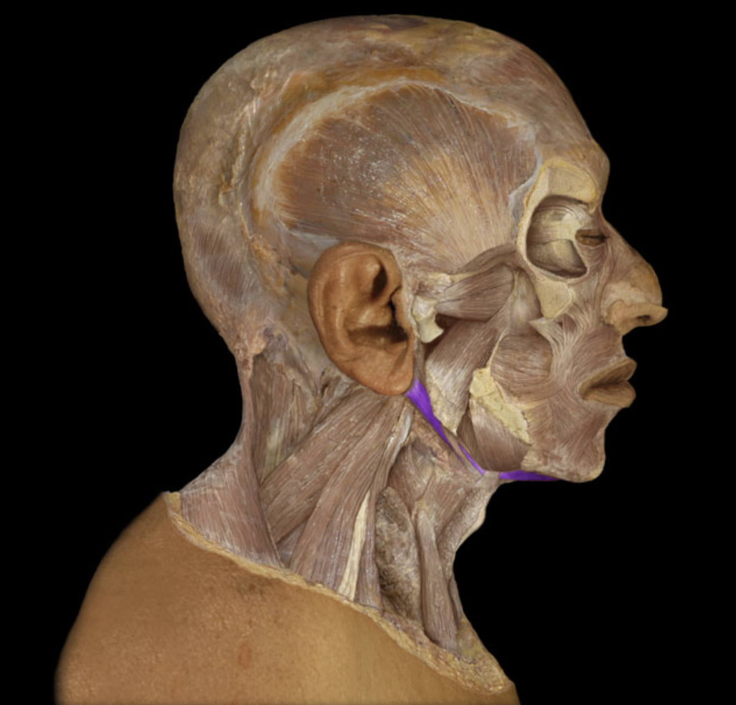 <p>What is/are this muscle’s origin(s)?</p>
