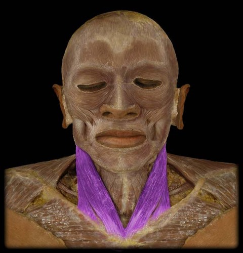 <p>v-shaped muscle in neck, Flexion of neck, rotating head</p>