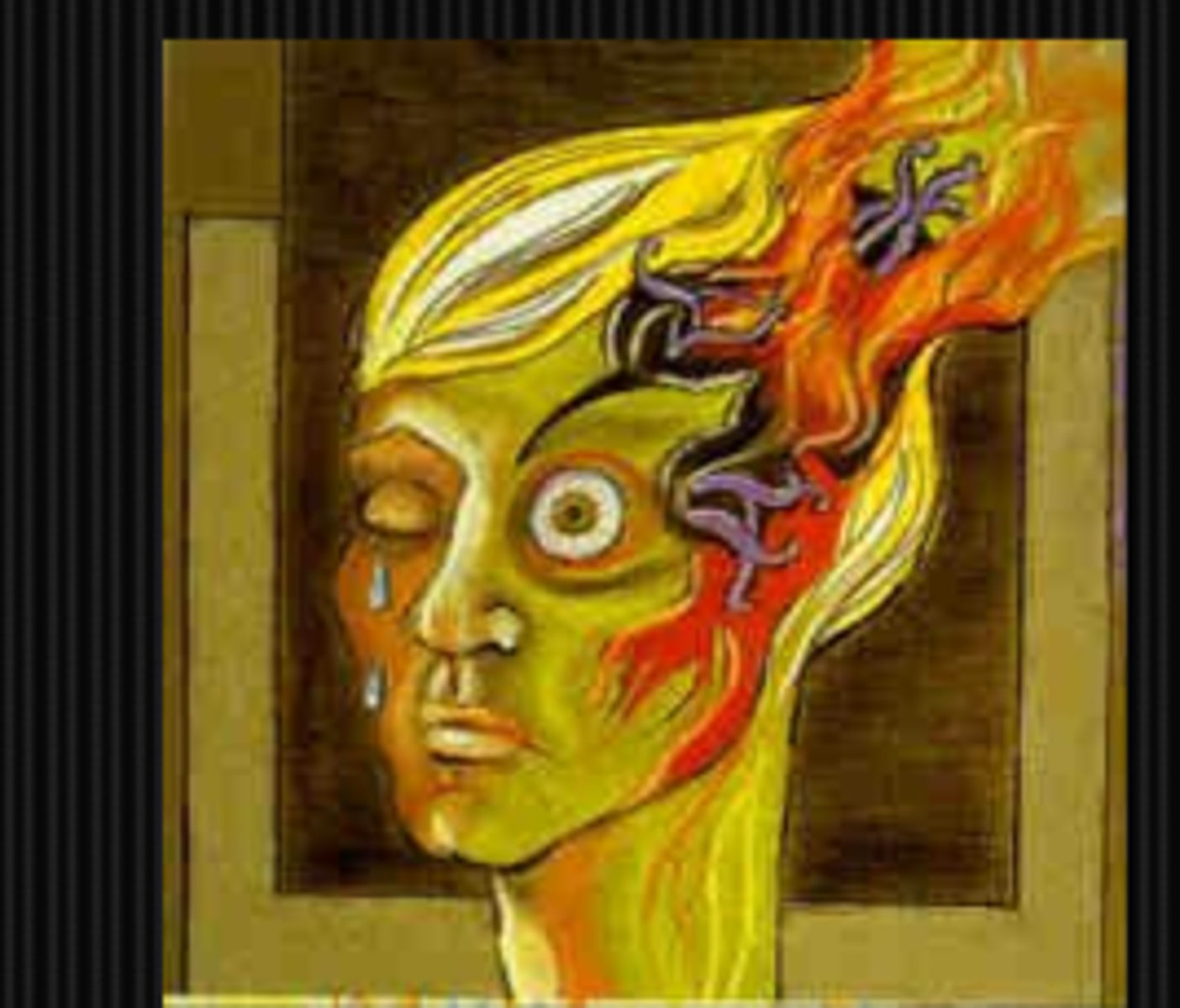 <p>BRAO or CRAO</p><p>resolving optic neuritis</p><p>classic migraine prodrome (younger pt, w/ flashing lights, nausea, emesis, head pain)</p><p>something pulling on retina like PVD, VMT</p>