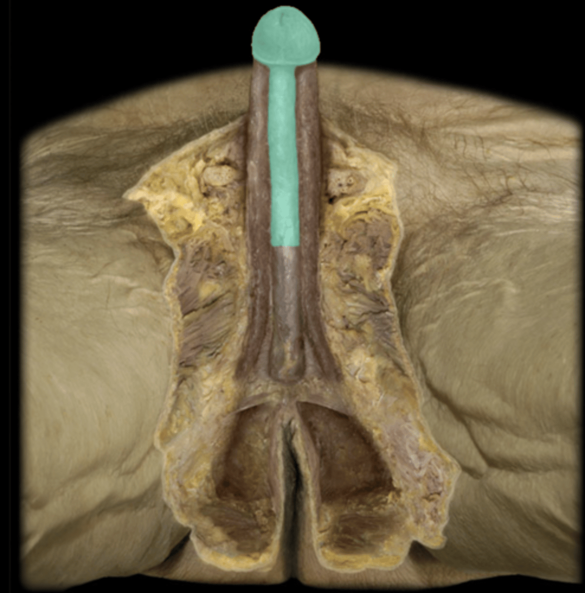 <p>TISSUE</p>