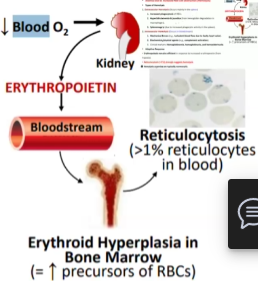 <ul><li><p><span style="color: red">Extravascular hemolysis</span></p><ul><li><p>Increased phagocytosis of RBCs in <span style="color: red">SPLEEN</span></p></li><li><p>Causes hyperbilirubinemia, jaundice and splenomegaly</p></li><li><p><span style="color: red">BETA THALASSEMIA IS EXTRAVASCULAR HEMOLYSIS!</span></p></li></ul></li><li><p>Intravascular hemolysis</p><ul><li><p>Increased RBC destruction due to mechanical forces like turbulent flow OR due to biochemical agents such as immune response</p></li><li><p>Erythropoiesis remains efficient</p></li></ul></li></ul><p></p>