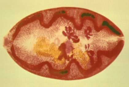 <p>in human, dog, pig, feline, carnivore</p><p>lung fibrosis, seizures, secondary pneumonia</p><p>history of eating raw/pickled crustaceans</p><p>East Asia, Africa, East Russia, Indian Subcontinent, Pacific Asia, Americas</p>