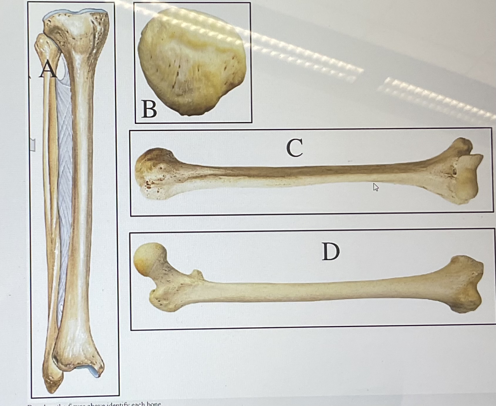 <p>based on the figure above identify each bone </p>