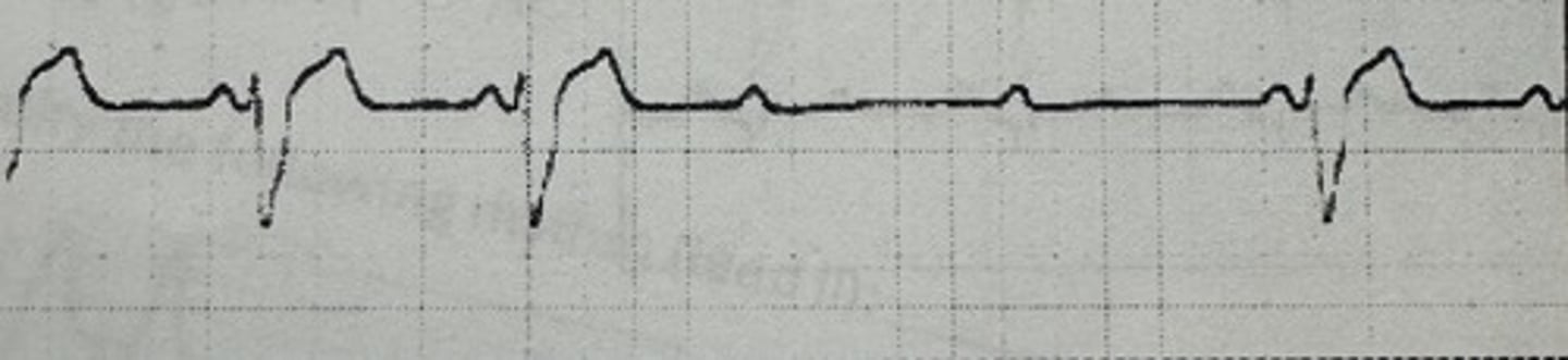 <p>identify the rhythm</p>