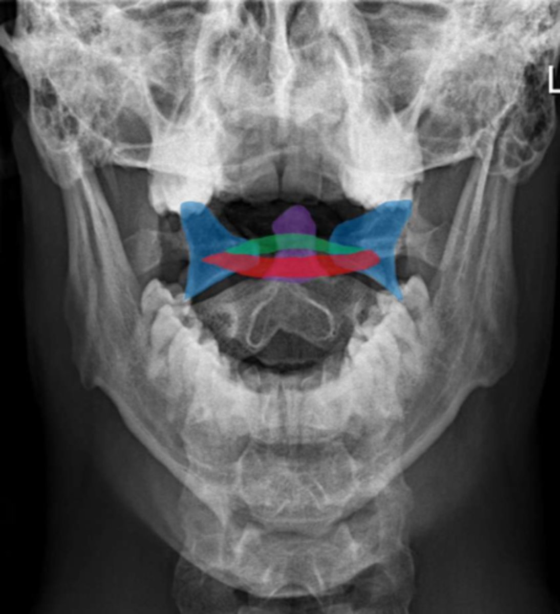 <p>Identify the purple structure</p>