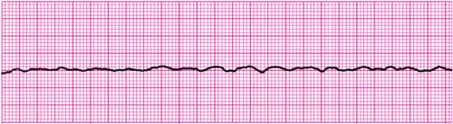 <p>Fine and fibrillatory</p>