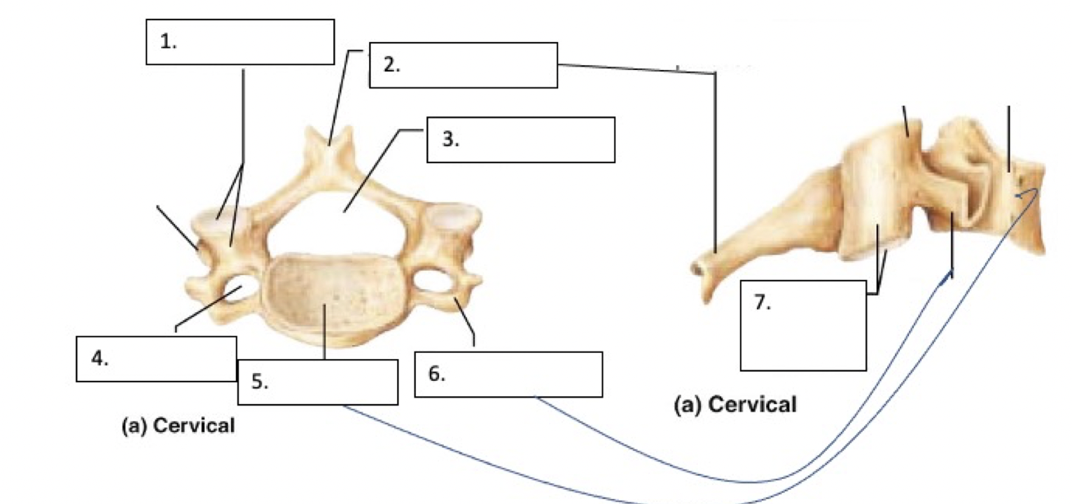 <p>Vertebral foramen</p>