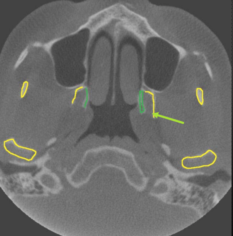 <p>what structure is the arrow pointing to </p>
